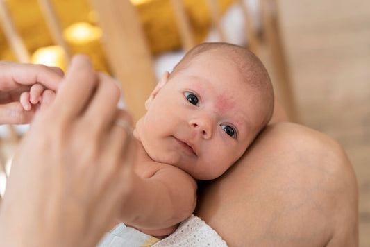 Allergie alimentari nei bebè: dermatite