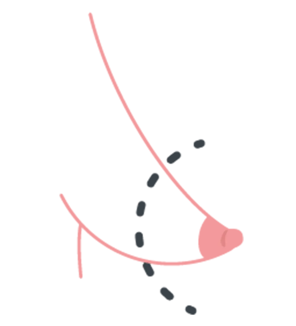 Tubulaire