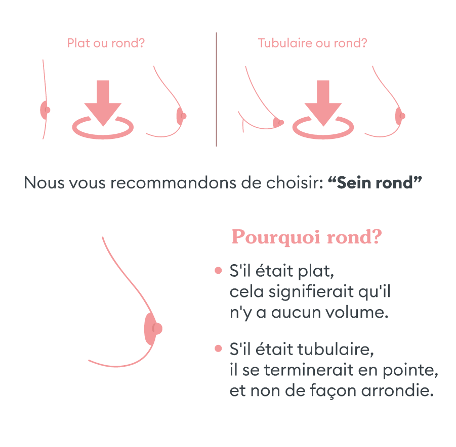 Des doutes sur la forme?