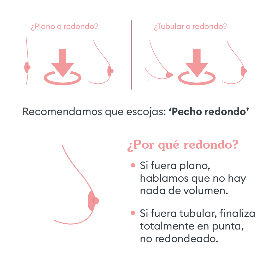 ¿Dudas sobre la forma?