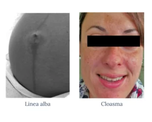 como saber si estoy embarazada linea alba